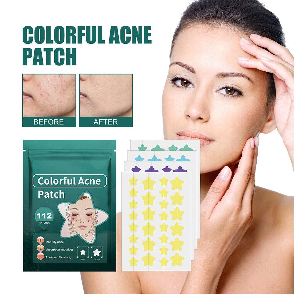 112pcs Invisible Acne Removal Pimple Patch Cute Star Shaped for Face Healing