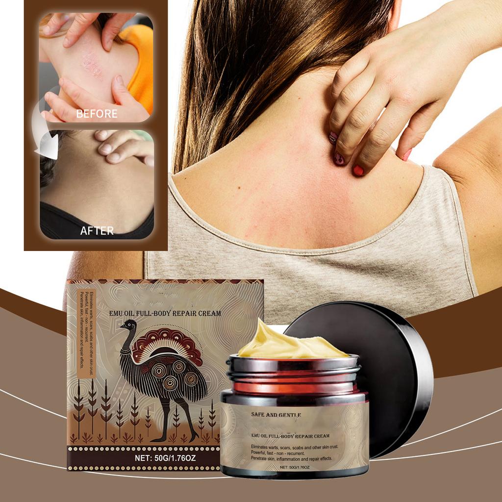 Крем для ухода за кожей для облегчения псориаза - банка 50 г от покраснения и раздражения