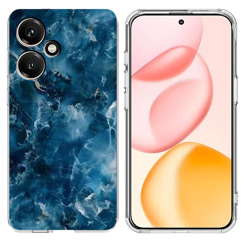 Для Honor 400 5G (Глобальный) Чехол Печать Мраморный Узор Мягкий ТПУ Чехол для Телефона