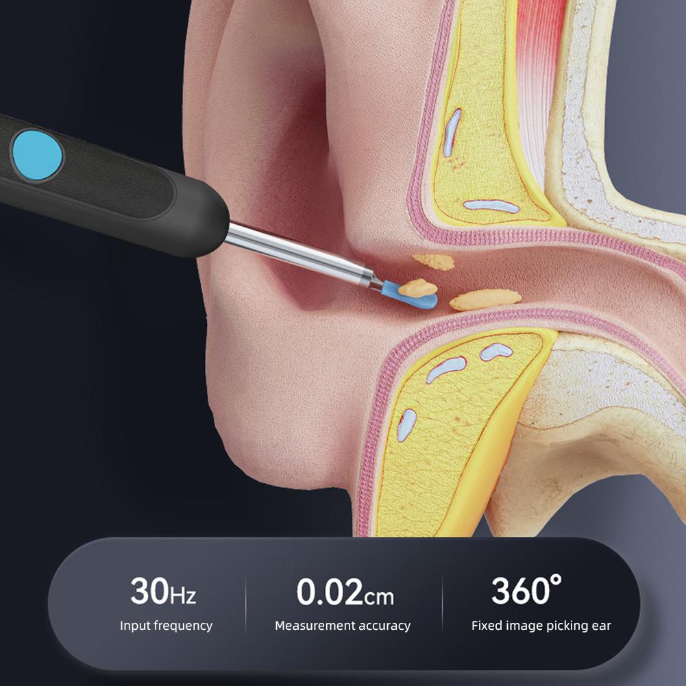 Высококачественная интеллектуальная визуальная ложка для чистки ушей, беспроводная перезаряжаемая светящаяся ложка для чистки ушей, инструмент для удаления ушной серы, уход за ушами