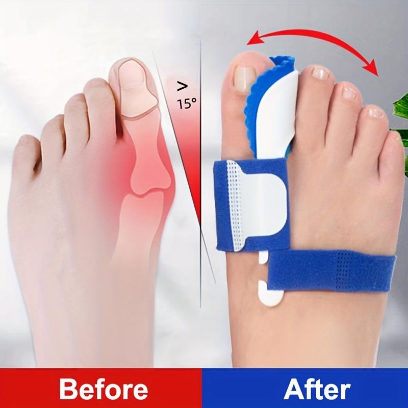 2PCS Corrector Foot Orthopedic Professional Tools Spa Bunion Corrector Toe Separator Feet Care Thumb Night Daily