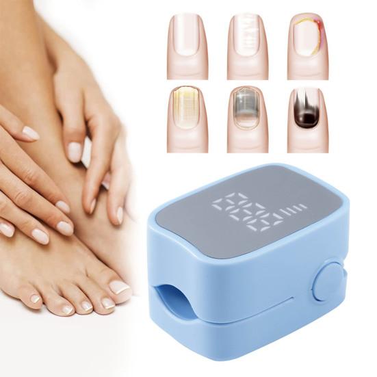 Nail Fungus Treatment LED Device 460nm Blue Light USB Charge Onychomycosis Cleaner