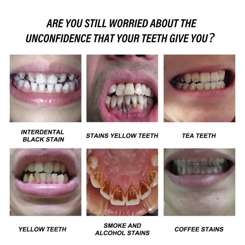 Отбеливающая зубная паста, уход за деснами, чистые пятна, желтые зубы, зубной камень, удаление запаха изо рта, предотвращение разрушения зубов, свежее дыхание, ремонт зубов.