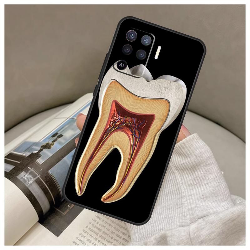 Чехол с анатомией зуба человека для Oppo A74 A94 A54 A18 A38 A58 A78 A98 A80 A60 A40 A96 A76 A16 A15 A17 A57 A77 A5 Pro