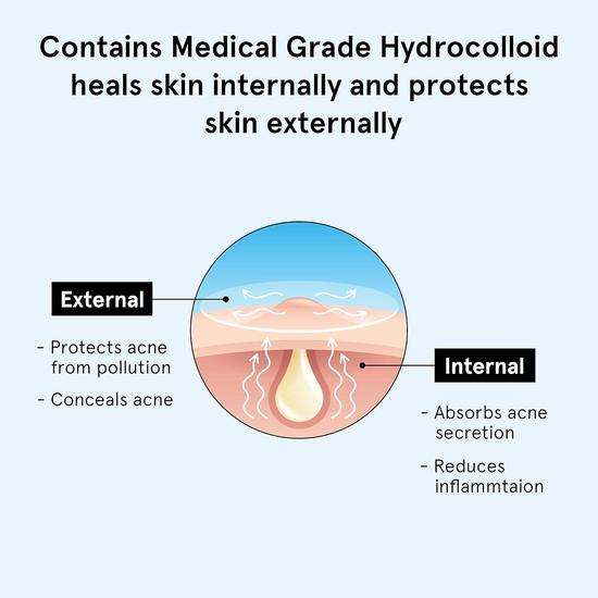 Пластырь от прыщей Be Bodywise для женщин(24 точки | 3 размера) и 2% салициловой кислоты для умывания лица для женщин 100 мл | Глубоко очищает кожу и предотвращает появление прыщей