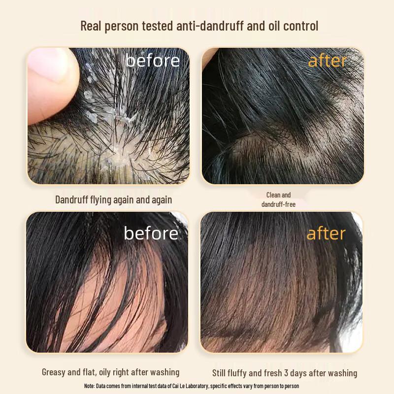 Cailao White Truffle Anti-Dandruff Oil Control Volumizing Shampoo