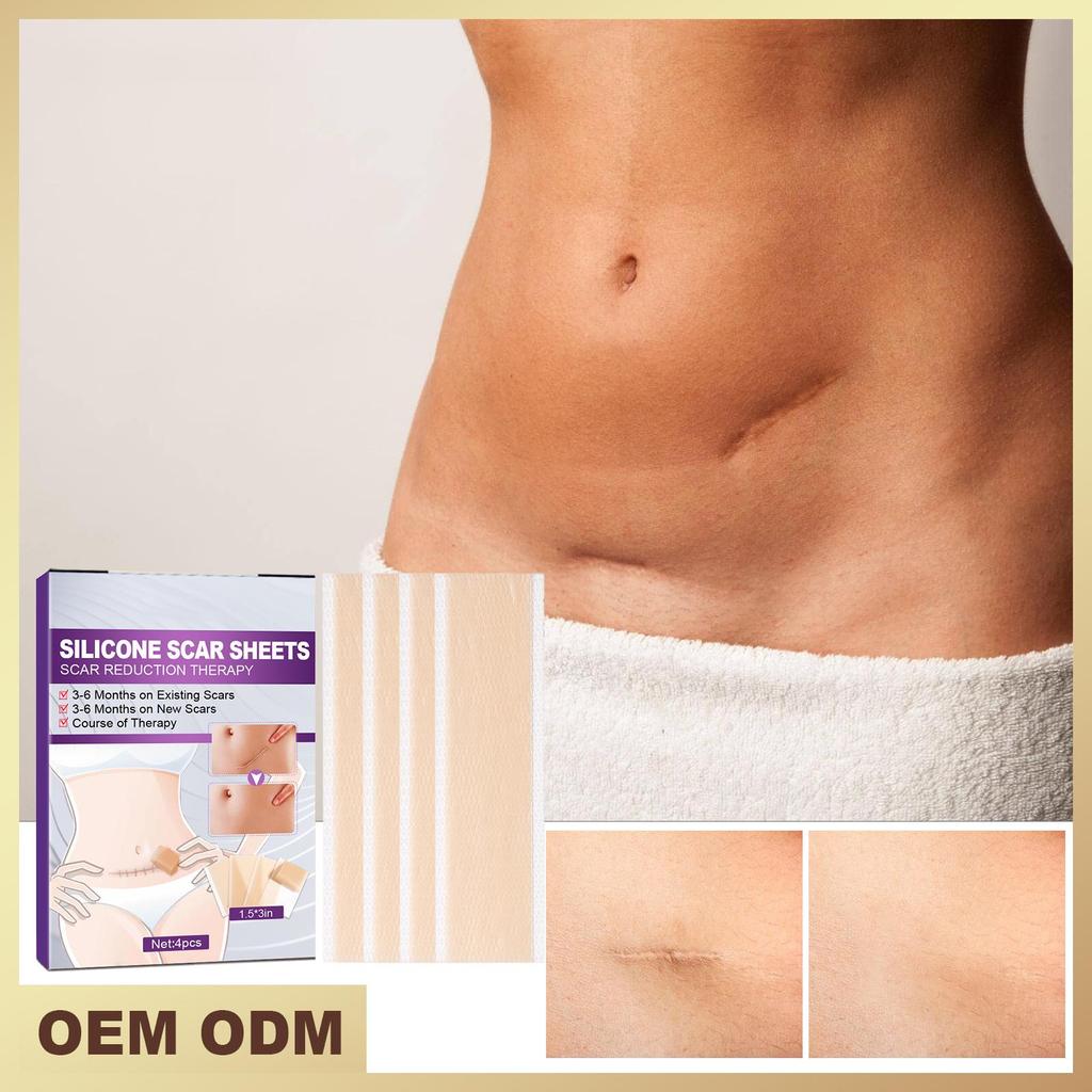 Silicone Scar Tape Scar Sheets for Removing Scars Adaptable Easy-Tear Scar Tape Reusable for C-Section