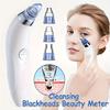 Electric Pore Vacuum Blackhead Remover Facial Cleansing Device with 2 Speed Settings  3 PP Tips