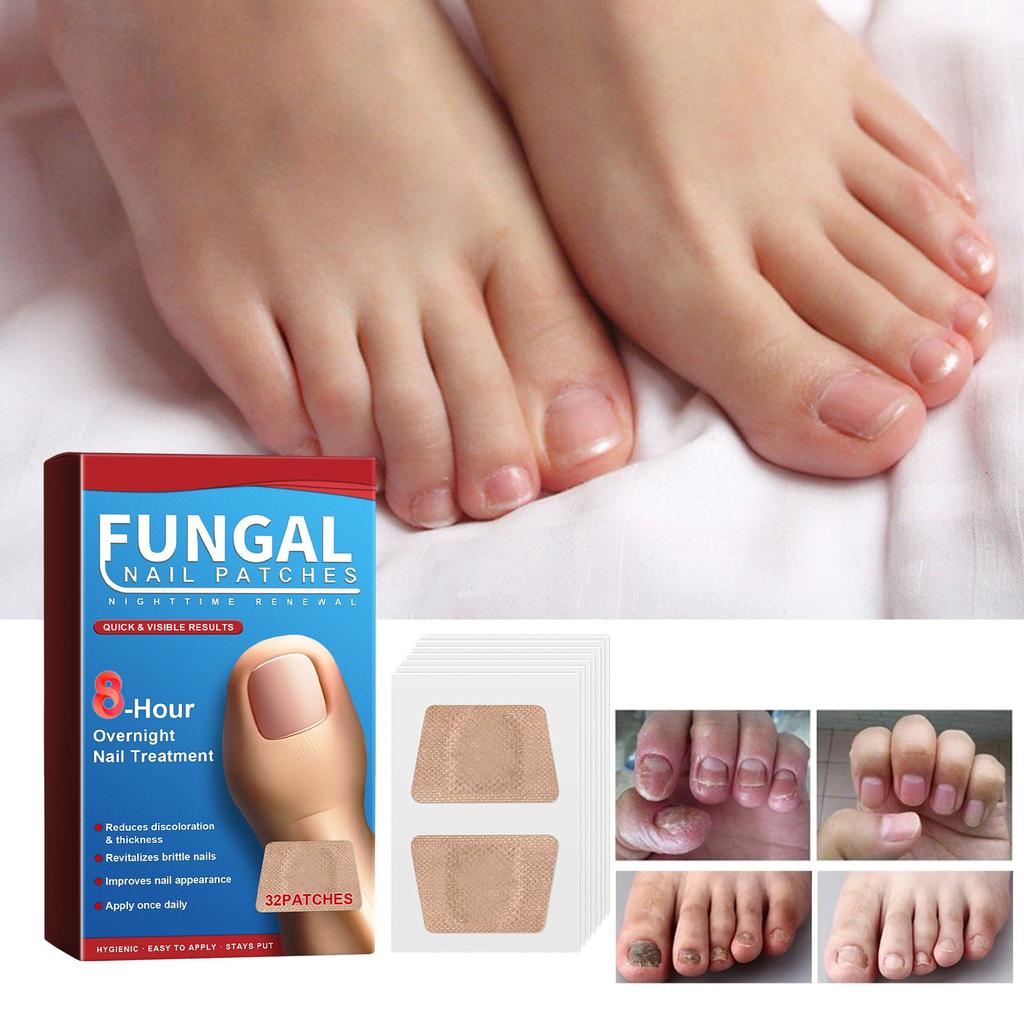 Пластыри для ухода за ночными ногтями Пластыри для ухода за ногтями Пластыри для ухода за утолщенными ногтями Вросшие ногти и мягкие ногти Пластыри для ухода за ногтями
