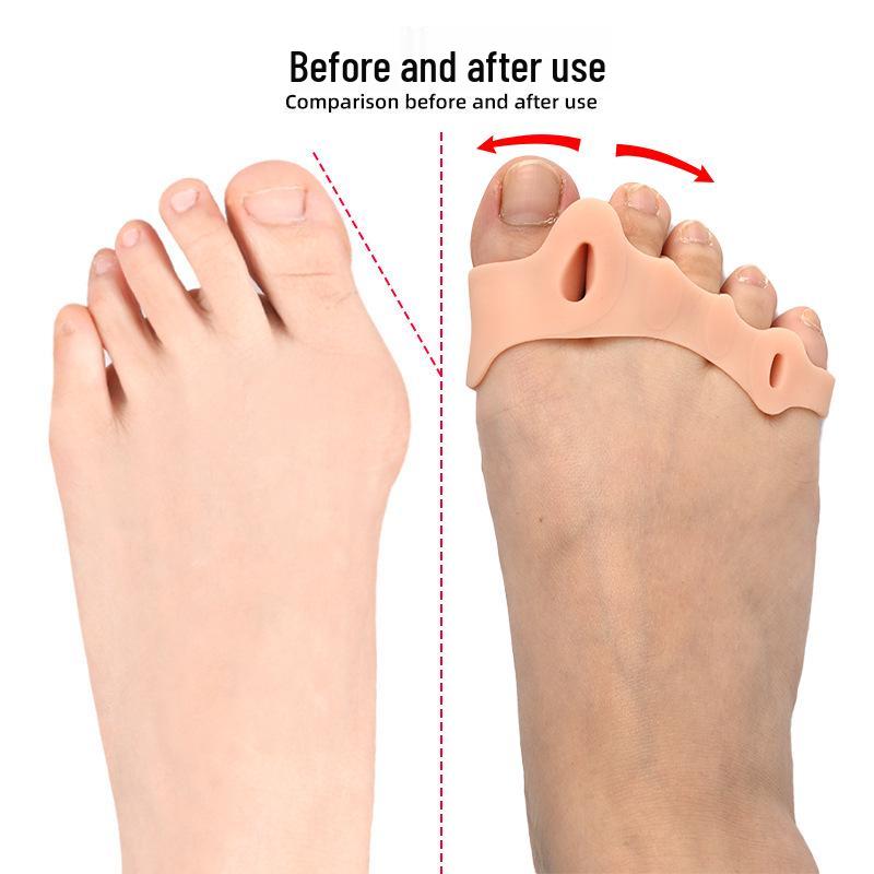 Silicone Forefoot Arch Support & Thumb Corrector Pad
