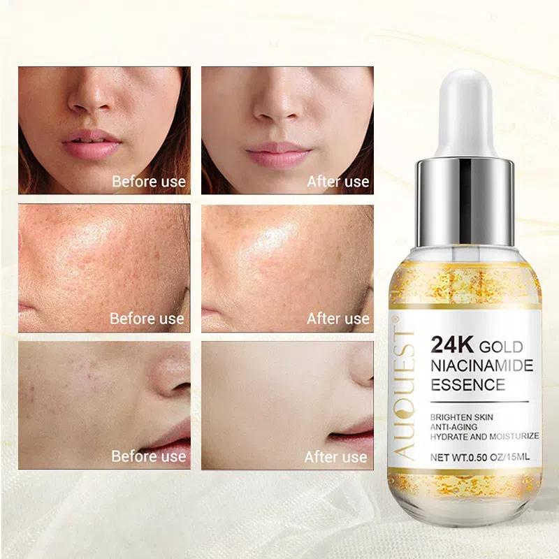 24-каратная золотая сыворотка Essence Gold сужает поры, удерживает воду и увлажняет