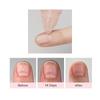 [Lement] Keratin Smoother Nail Nutrient Serum (11ml) - Advanced Skin-Surface Amino Density Booster & Texture Refiner