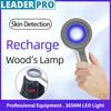 Перезаряжаемая лампа Вуда для осмотра кожи, медицинский диагностический анализатор, прибор для личной гигиены, ультрафиолетовая лампа