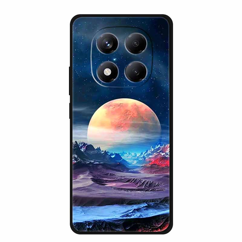 For Xiaomi Redmi Note 15 Pro / Note 15 Pro+ 5G Case Global Version 25060RABDG 2510ERA8BG Luxury Soft Silicone Back Cover Cases