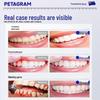 PETAGRAM Спрей для облегчения зубной боли
