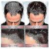 3pcs Zephta H-regrow 2.0, Zephta Hair Regrowth, Prorevita Rice Nutri Spray, For Hair Hk
