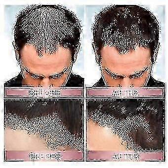 3pcs Zephta H-regrow 2.0, Zephta Hair Regrowth, Prorevita Rice Nutri Spray, For Hair Hk