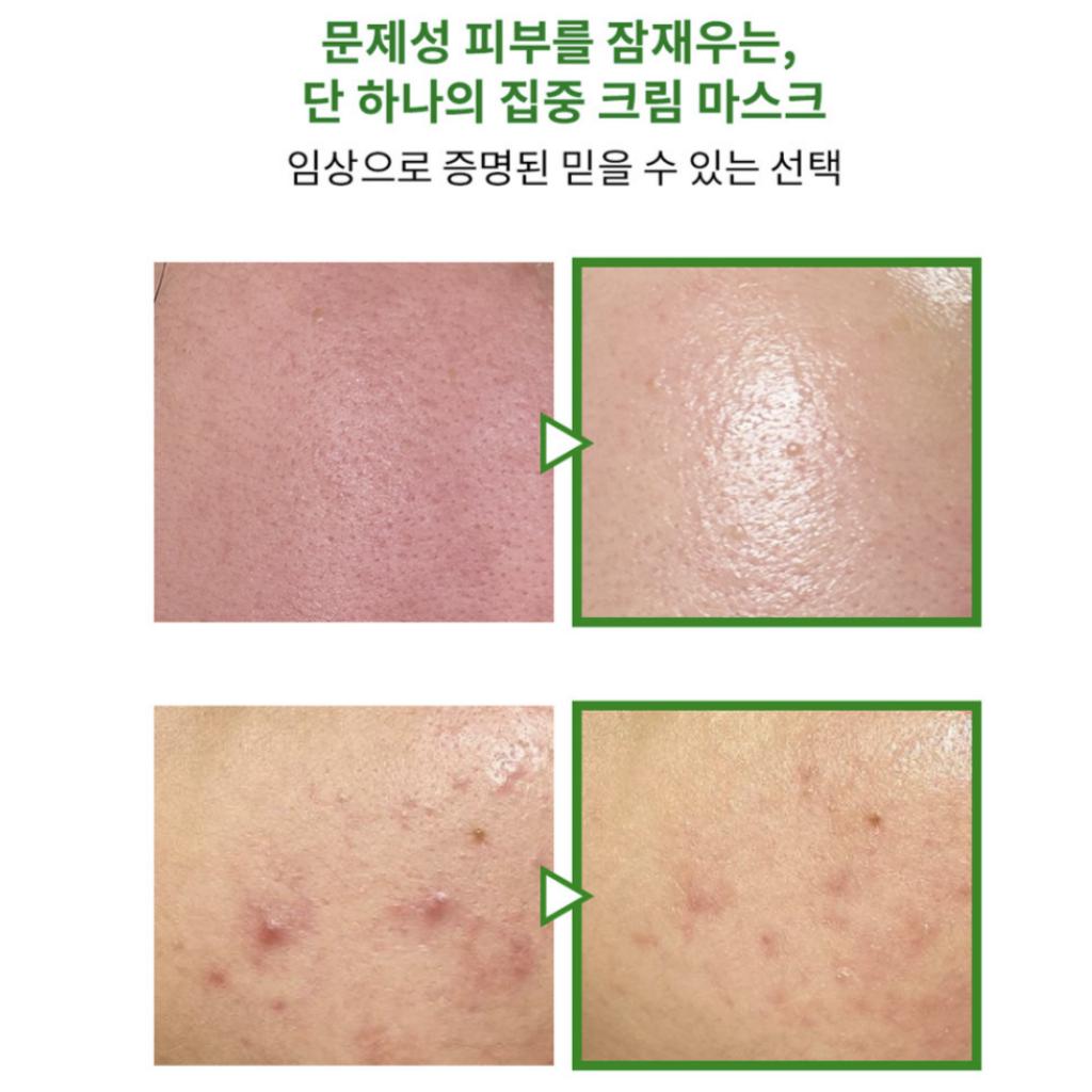 [ВЕМОНТЕС] Бустер-крем-маска Axcne 150 мл