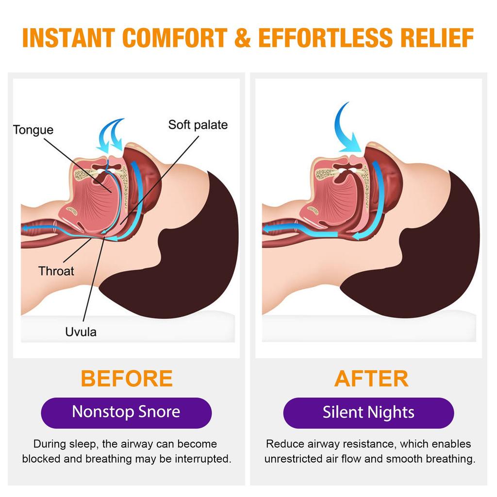 Anti-snoring Spray, Fast-acting Snoring Drops, Improve Sleep, Effectively Stop Snoring, Help Open The Throat And Airway During Sleep30ml