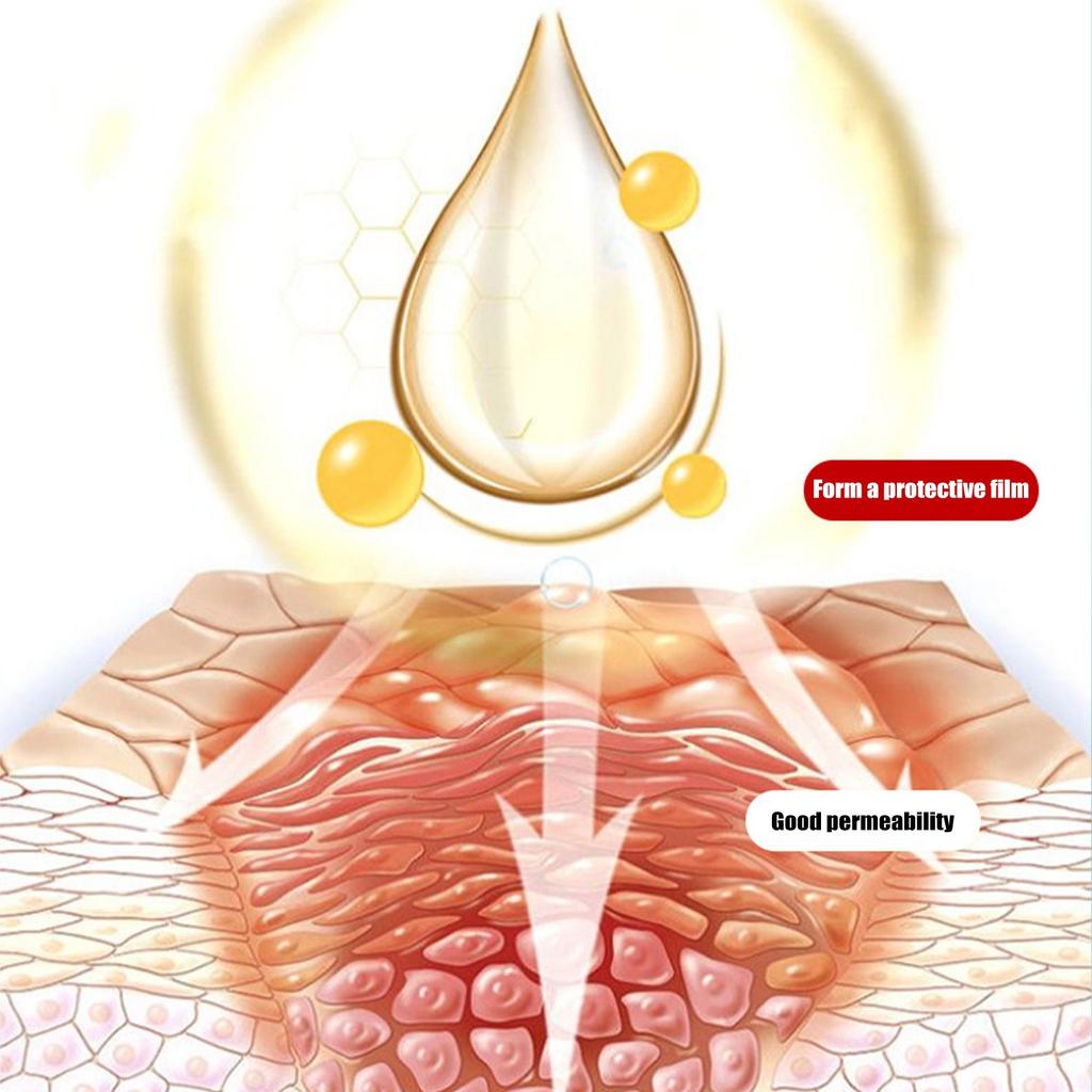 Спрей для растворения зубного камня Fresh Mouth Care Портативный спрей для полости рта 20 мл