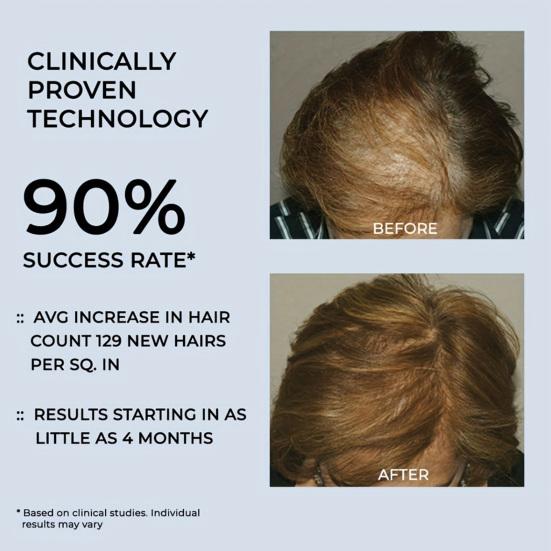 Шапочка для фототерапии с красным светом для восстановления здоровья волос 96 светодиодов Мужчины Женщины Лечение истончения волос Уменьшение перхоти Красные шапки для терапии ближним инфракрасным светом