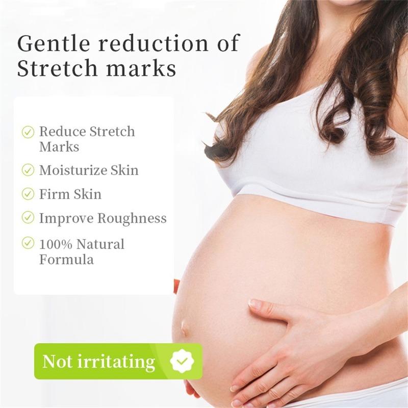 Best Organic Repair Scar Cream Natural Cellulite Removal Anti Pregnancy Stretch Marks Cream For Female