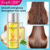 Fast Powerful Hair Growth Essence Essential Oil Liquid Treatment Hair Repair Hair Care Products