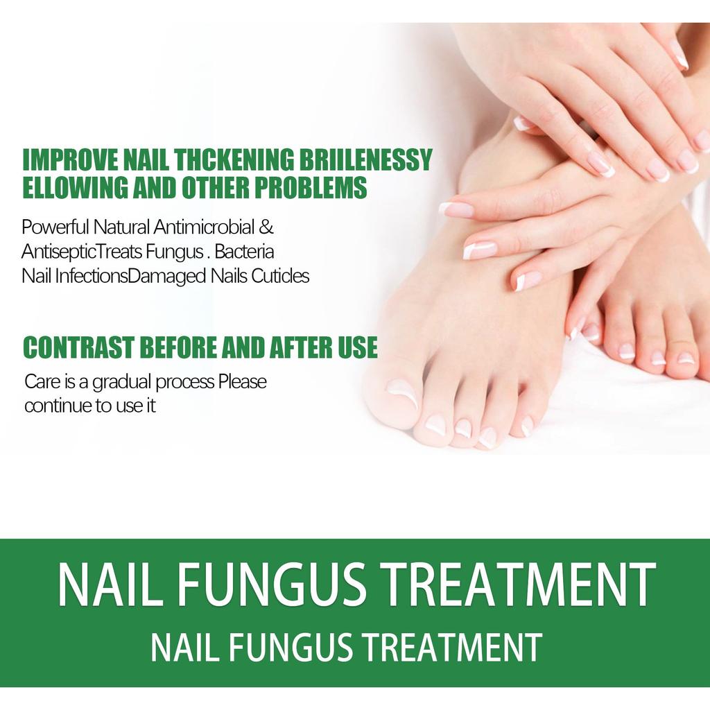 30ml Nail Repaird Solution, FootNail Tea-Tree Oil, Thick And Soft Nail Nutrition Hand And Foot Nail Care Solution