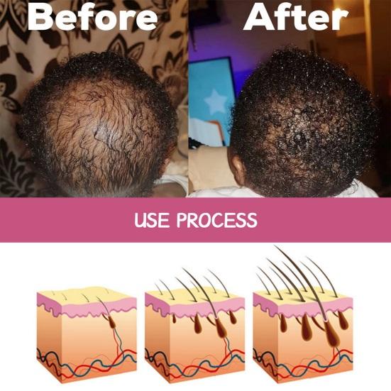 60ML Batana Hair Care Oil Natural Plants Extract Men Women Dry Damaged Split Hair Growth Hydrating Smoothing Repair Essential Oil