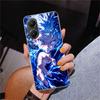 Huner X-Hunters Killua Phone Case For Xiaomi Poco X7 X6 X5 Pro F7 Ultra Redmi 15C 15 13C 13 12C 12 10 10A 10C 9 9A 9C 9T Cover P