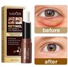 Retinol Eye Cream Removing Dark Circles Wrinkle Lightening Fine Lines Moisturizing Whitening Skin Care Remove Eye Bag