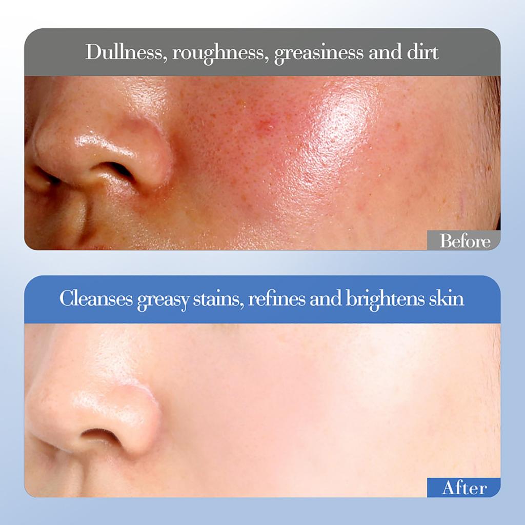 Набор для осветления и увлажнения кожи с рисом, набор увлажняющих продуктов. 100 г + 120 мл + 120 мл + 50 мл + 50 г + 20 г