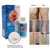 Foot Leg Veins Plaster Leg Spray Spray Swelling Healthy Professional Spray