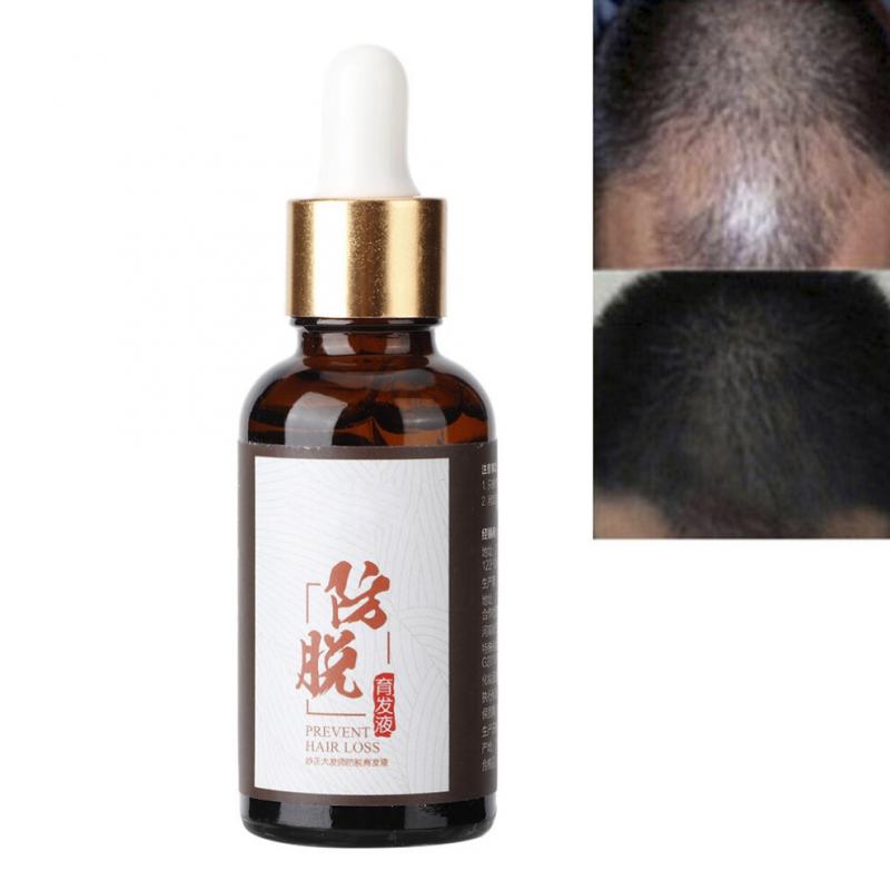 Daily scalp care, a fast-acting formula to promote hair growth, balances oil secretion, use 2-3 times daily 2pcs