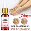 Toenail Fungal Super Strong Nail Care Nail Care Super Strong For Thick Discolored And Damaged Nails10ml