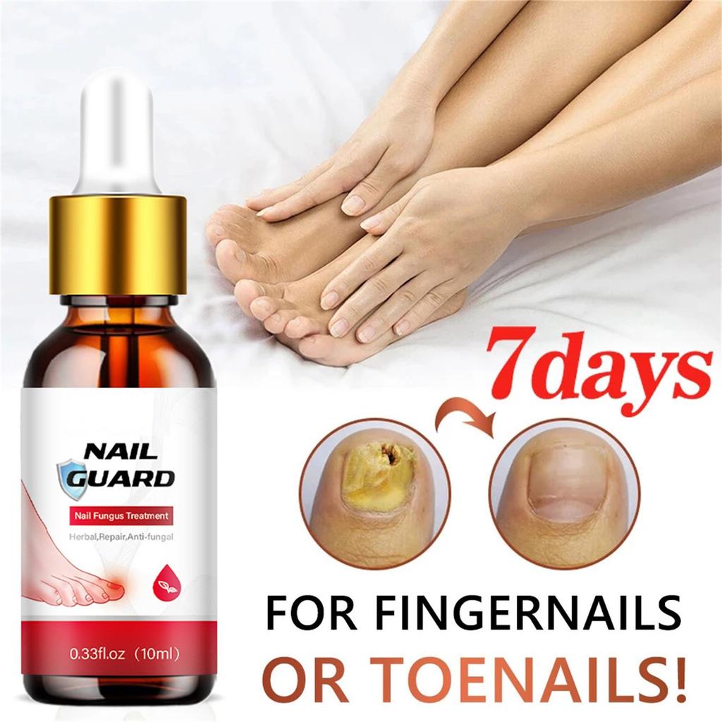 Toenail Fungal Super Strong Nail Care Nail Care Super Strong For Thick Discolored And Damaged Nails10ml