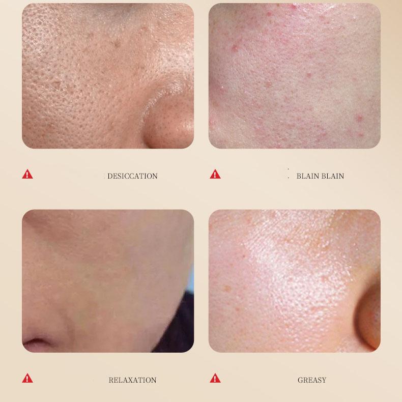 FENZEN гексапептид олигопептид эластичный лиофилизированный набор порошков коробка увлажняющий набор лиофилизированных порошков для кожи