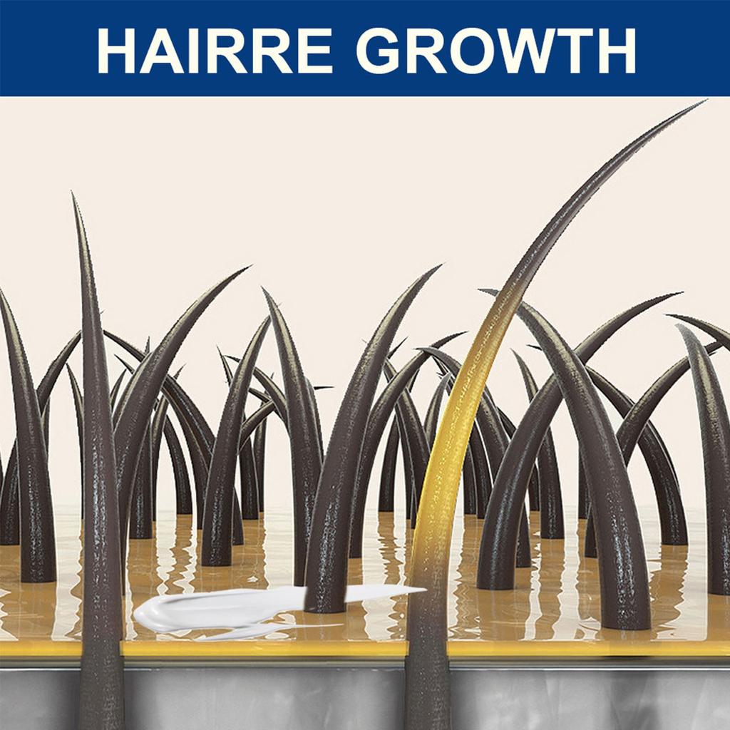 Крем от очаговой алопеции, устраняет выпадение волос, активизирует волосяные фолликулы, способствует росту