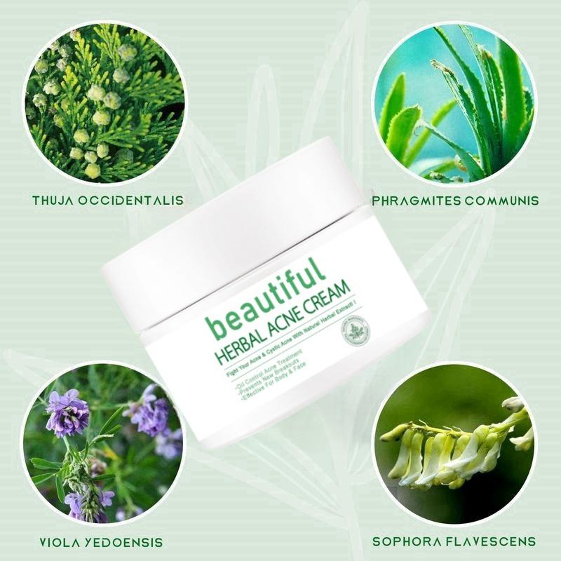 Acne Removing Cream, Acne Removing, Male and Female Students Fade Acne Marks, Acne Scar Removing Cream, Acne Pit Repairing