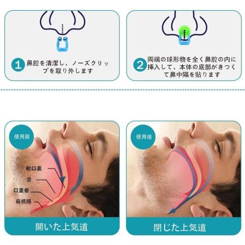 [Sleep Professional Supervised] Anti-Snoring Nose Clips, Snoring Prevention Aid, Snoring Preventer, Snoring Reduction Aid, Nostril Dilation, Sleep Aid