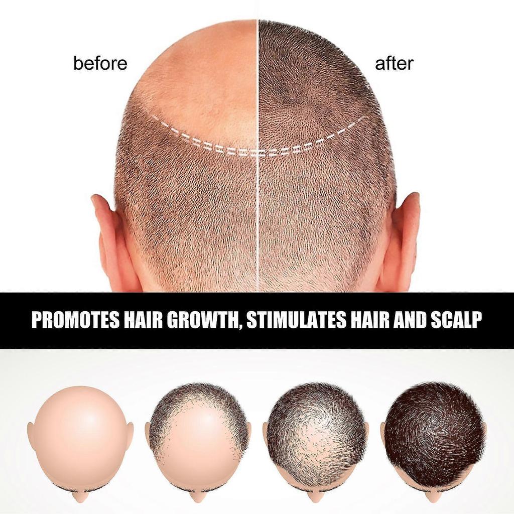 Jaysuing Hair Ampoule Essence Lotion - Thickens, Volumizes, Moisturizes, And Strengthens Hair