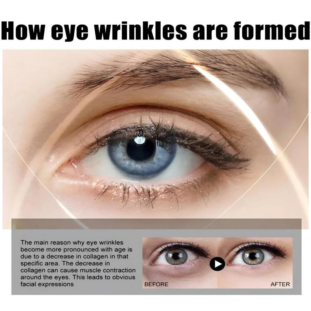 Крем для глаз уменьшает появление морщин вокруг глаз, делает область вокруг глаз более пухлой и гладкой, эффективно осветляя и подтягивая ее.