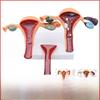 Amical Pathological Model of Human Fem Reproductive Uterus Teaching Model of Vagina Ovary for Gynecological Reproducti...