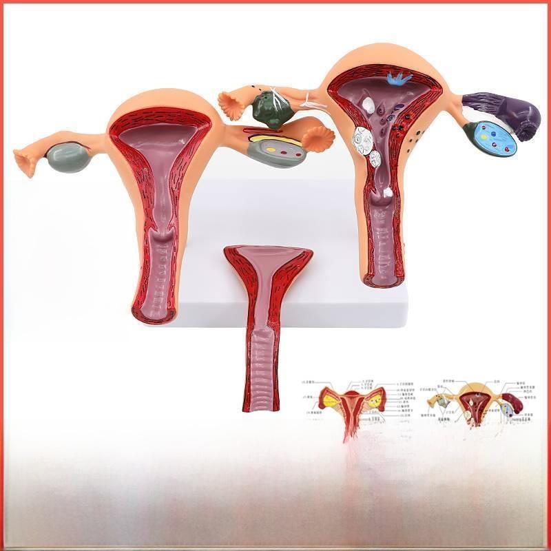 Amical Pathological Model of Human Fem Reproductive Uterus Teaching Model of Vagina Ovary for Gynecological Reproducti...