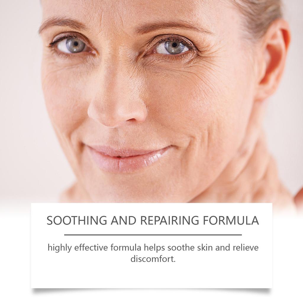 Whitening Cream Reduces Spots, Lightens Spots, Moisturizes, Locks In Moisture, Keeps Skin Hydrated For A Long Time.