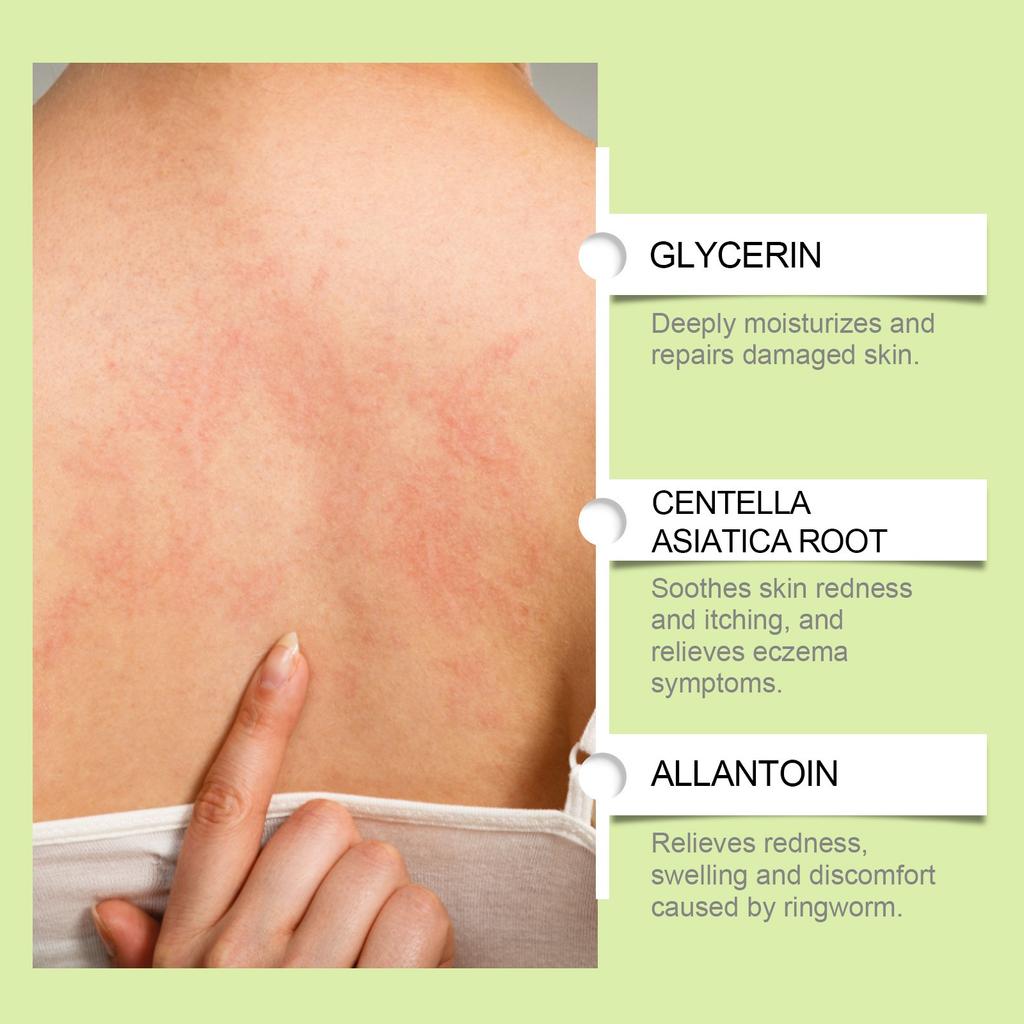 Herbal Skin Care Cream Gently Nourishes The Skin Of Hands And Feet And Smoothes The Skin