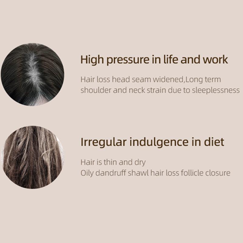 Электрический массажер для головы Scalphero, беспроводной массаж головы, терапия красным светом, водонепроницаемый массажер для тела, плеч, шеи, здравоохранение