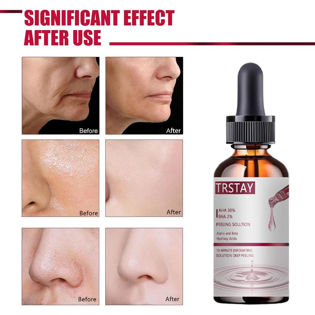 Dark Spot Corrector Cream, Ingredient, Enriching Skin Care For All Skin Tones, Melasma, Freckle, Sun Spot Improving For Women And Men