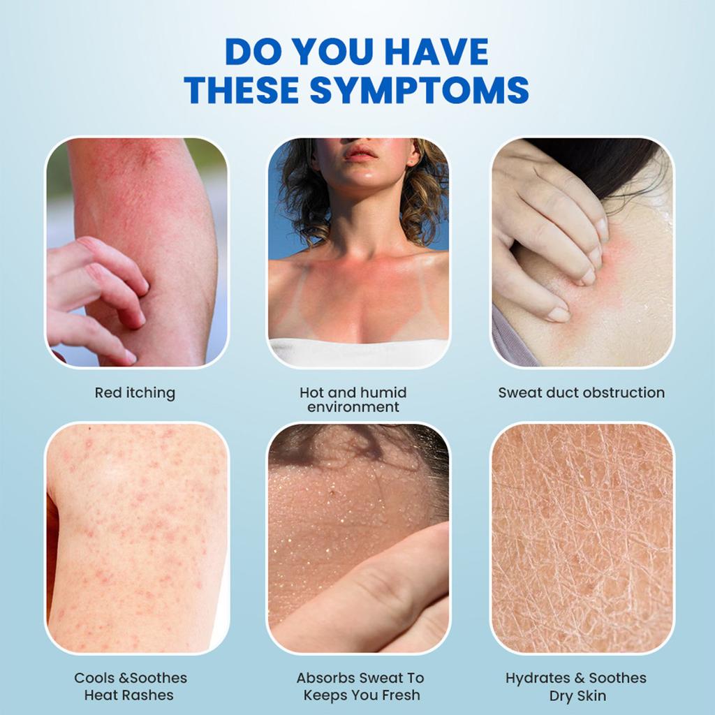 Heat Rash Spray, Quick Relief Of Itching 30ml