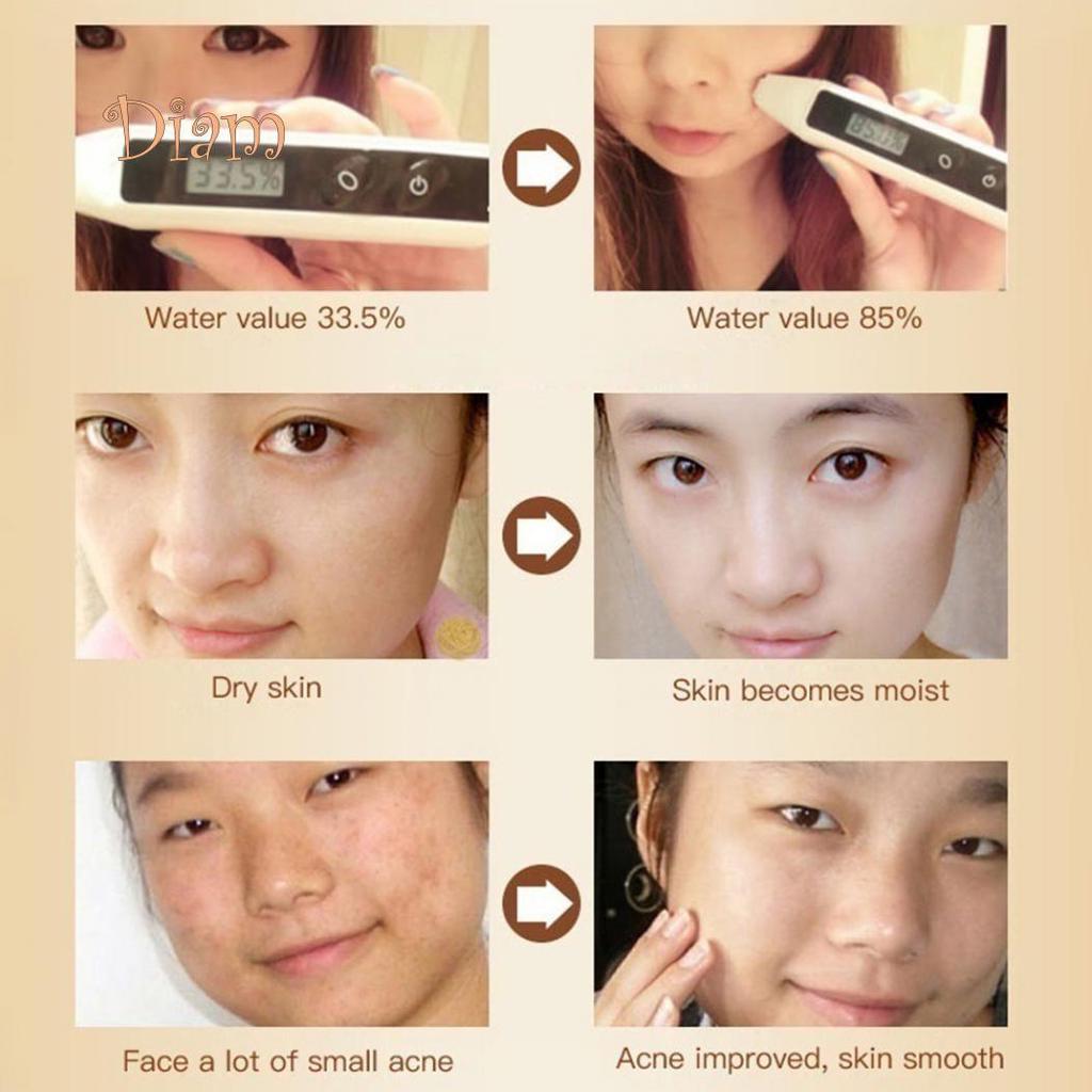 Водка 25 г Крем с улиткой против морщин, старение, укрепление, увлажнение, контроль жирности, эссенция